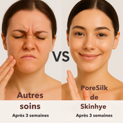 Sérum Anti-Pores & Impuretés