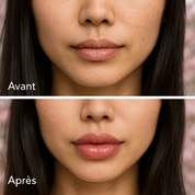 Japanese Lip Plumper