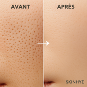 Sérum Anti-Pores & Impuretés
