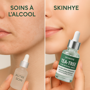 TeaTree Acne Serum