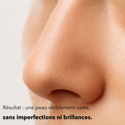 Masque anti-points noirs