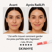 RadiLift – One Day PDRN Shot (nouveauté)