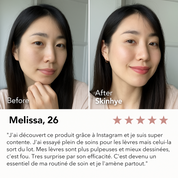 Japanese Lip Plumper