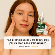 TeaTree Acne Serum